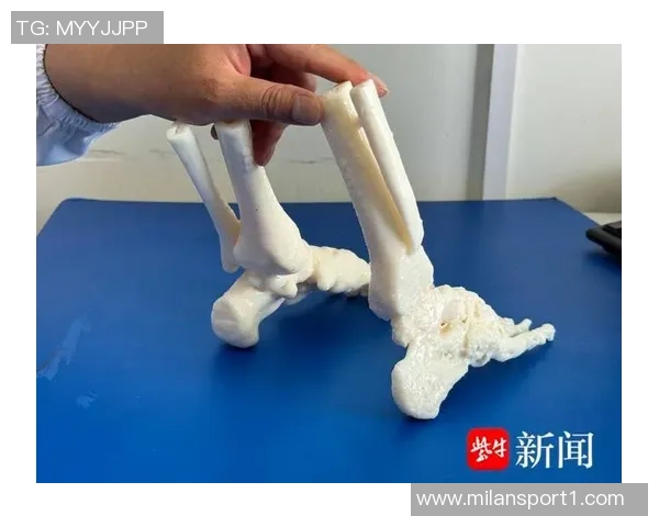 米体报道S希门尼斯考虑右脚踝手术决定将在未来几天做出 米体报道S希门尼斯考虑右脚踝手术决定将在未来几天做出